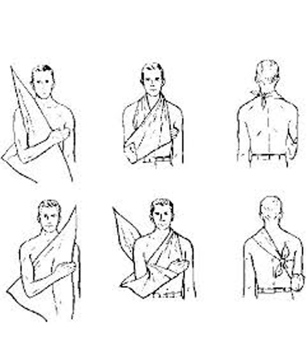 Triangular Bandage - Image 2